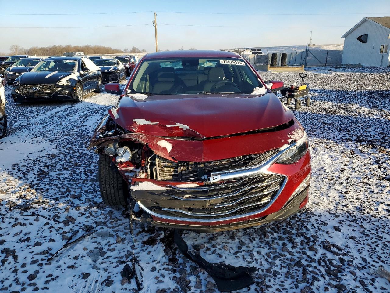 2024 Chevrolet Malibu Lt - Image 5