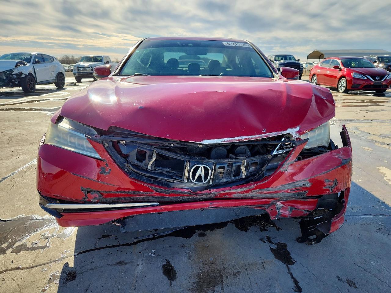 2017 Acura Tlx - Фото 5