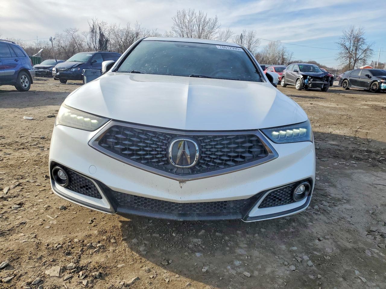 2019 Acura Tlx - Фото 5