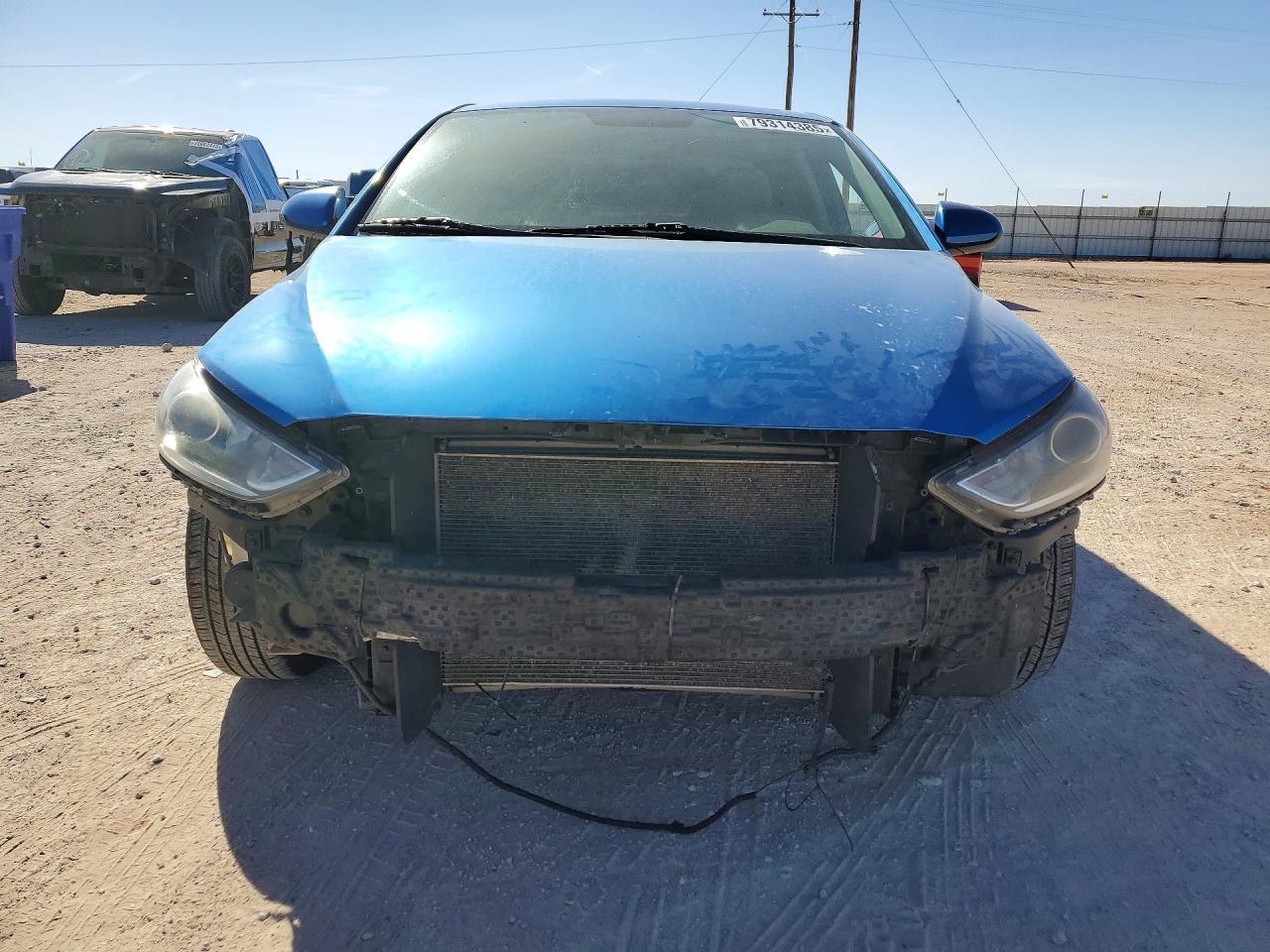 2017 Hyundai Elantra Se - Фото 5