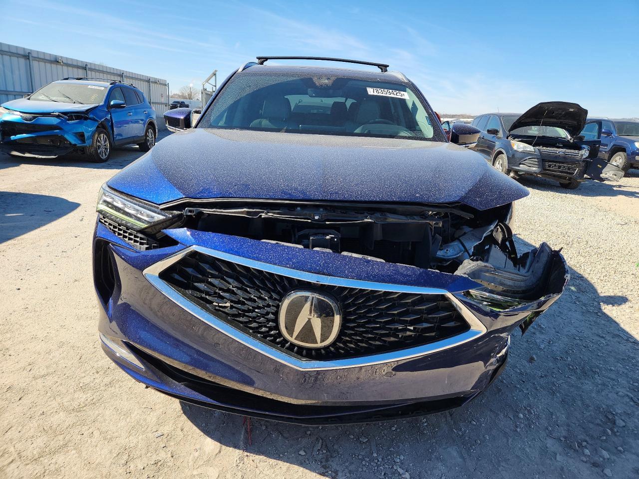 2022 Acura Mdx Advance - Image 5