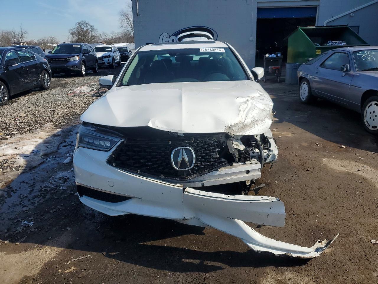 2018 Acura Tlx Tech - Фото 5