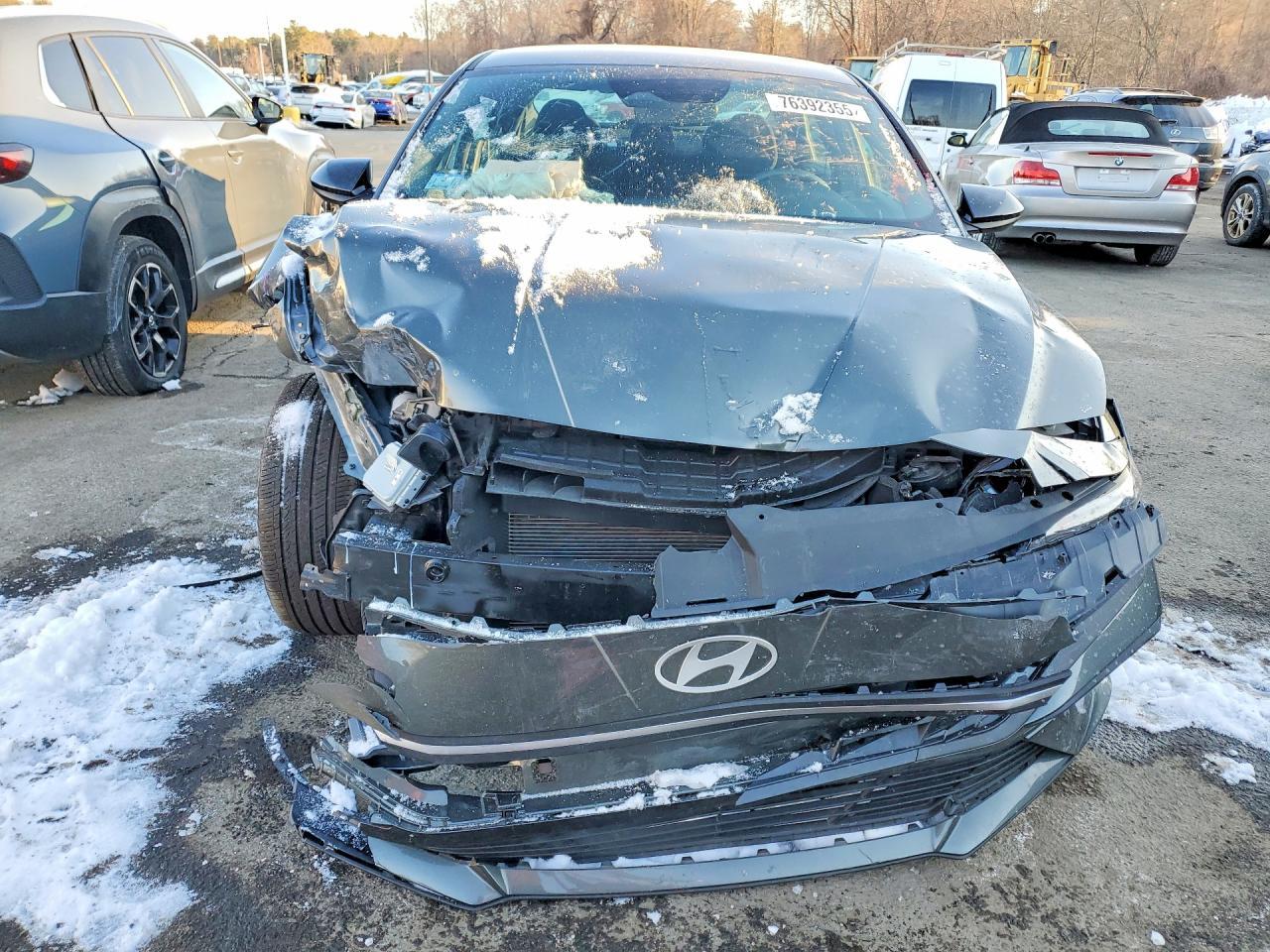 2025 Hyundai Elantra Sel Sport - Image 5