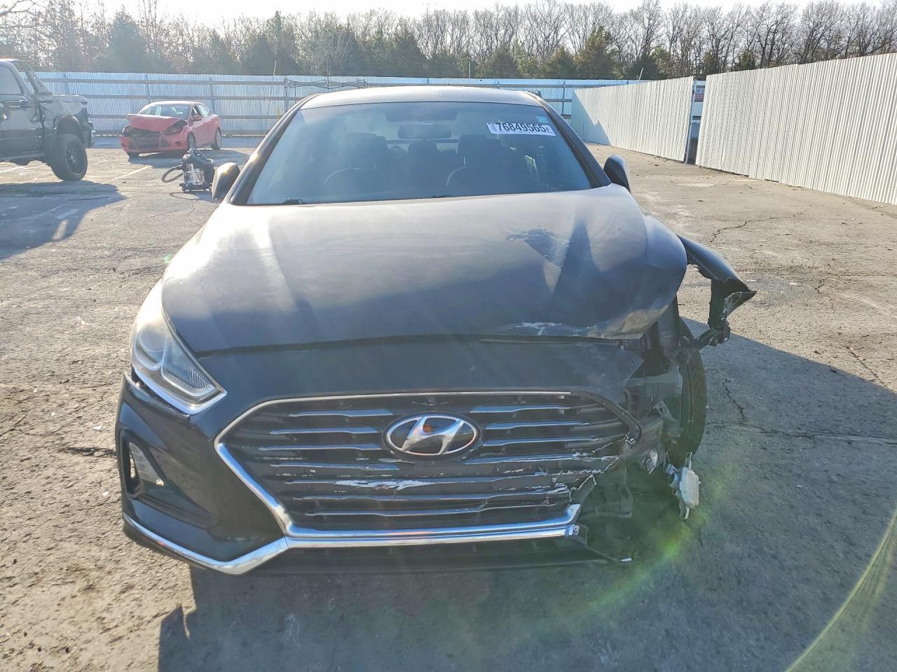 2018 Hyundai Sonata Se - Фото 5