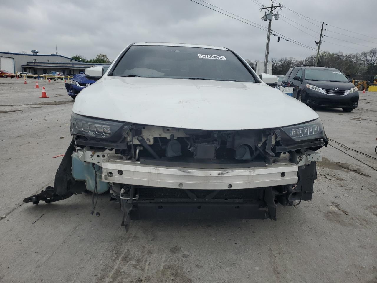 2018 Acura Tlx Tech+A - Image 5