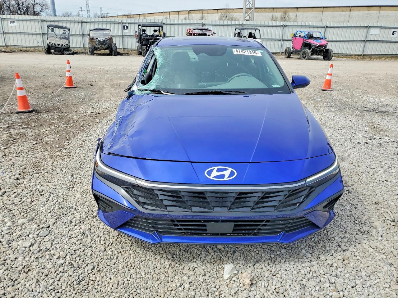 2025 Hyundai Elantra Sel Convenience - Image 5