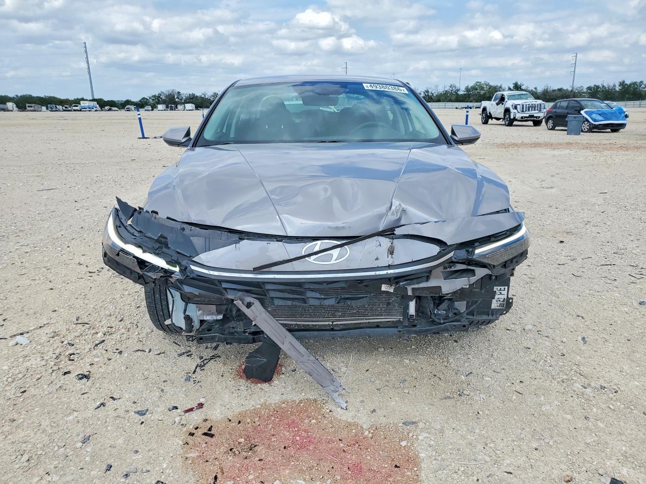 2024 Hyundai Elantra Sel - Фото 5