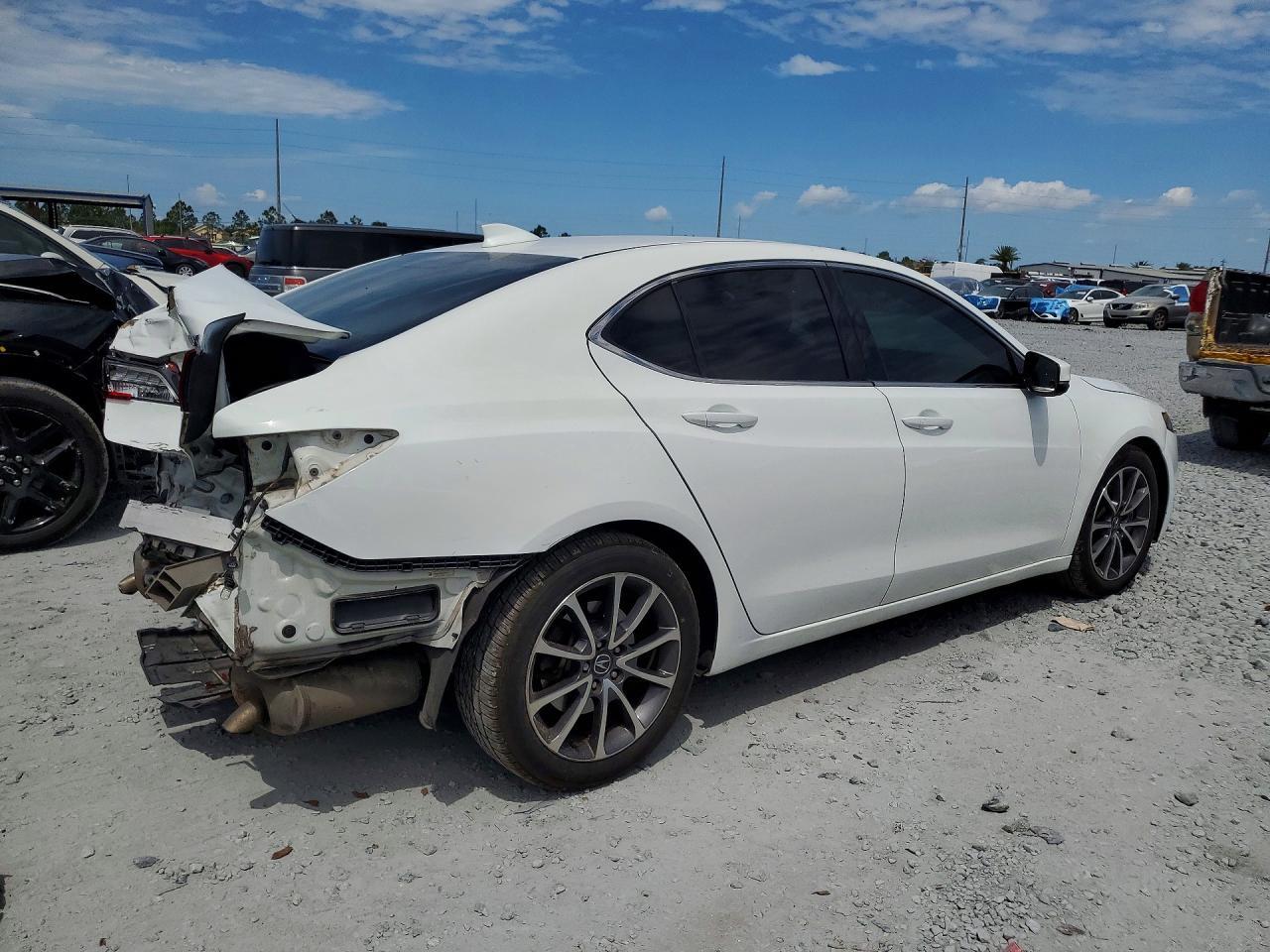 2017 Acura Tlx - Фото 3