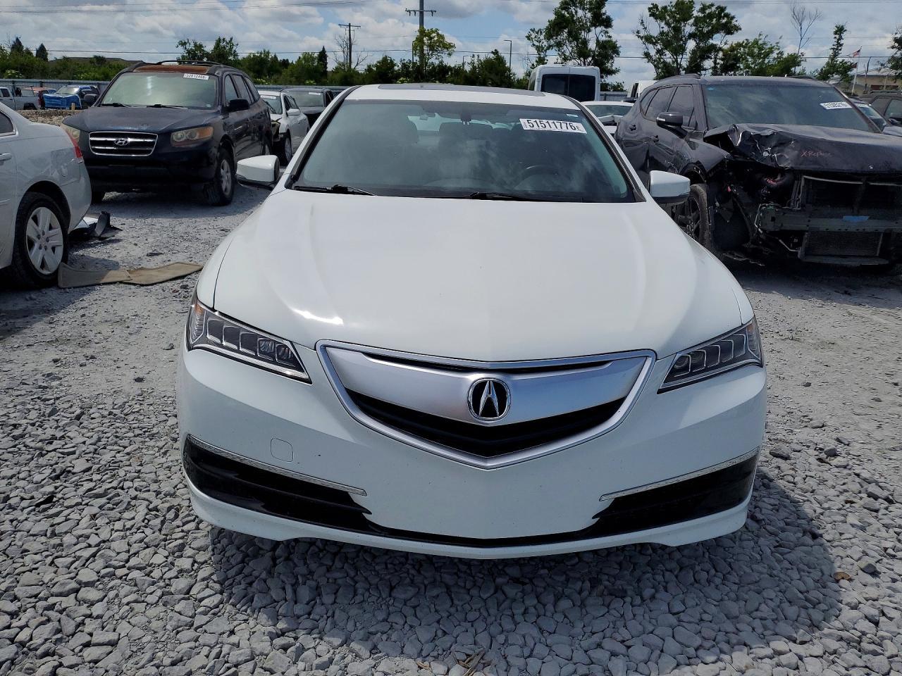 2017 Acura Tlx - Фото 5