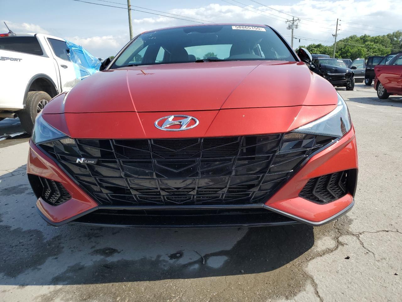 2021 Hyundai Elantra N Line - Фото 5