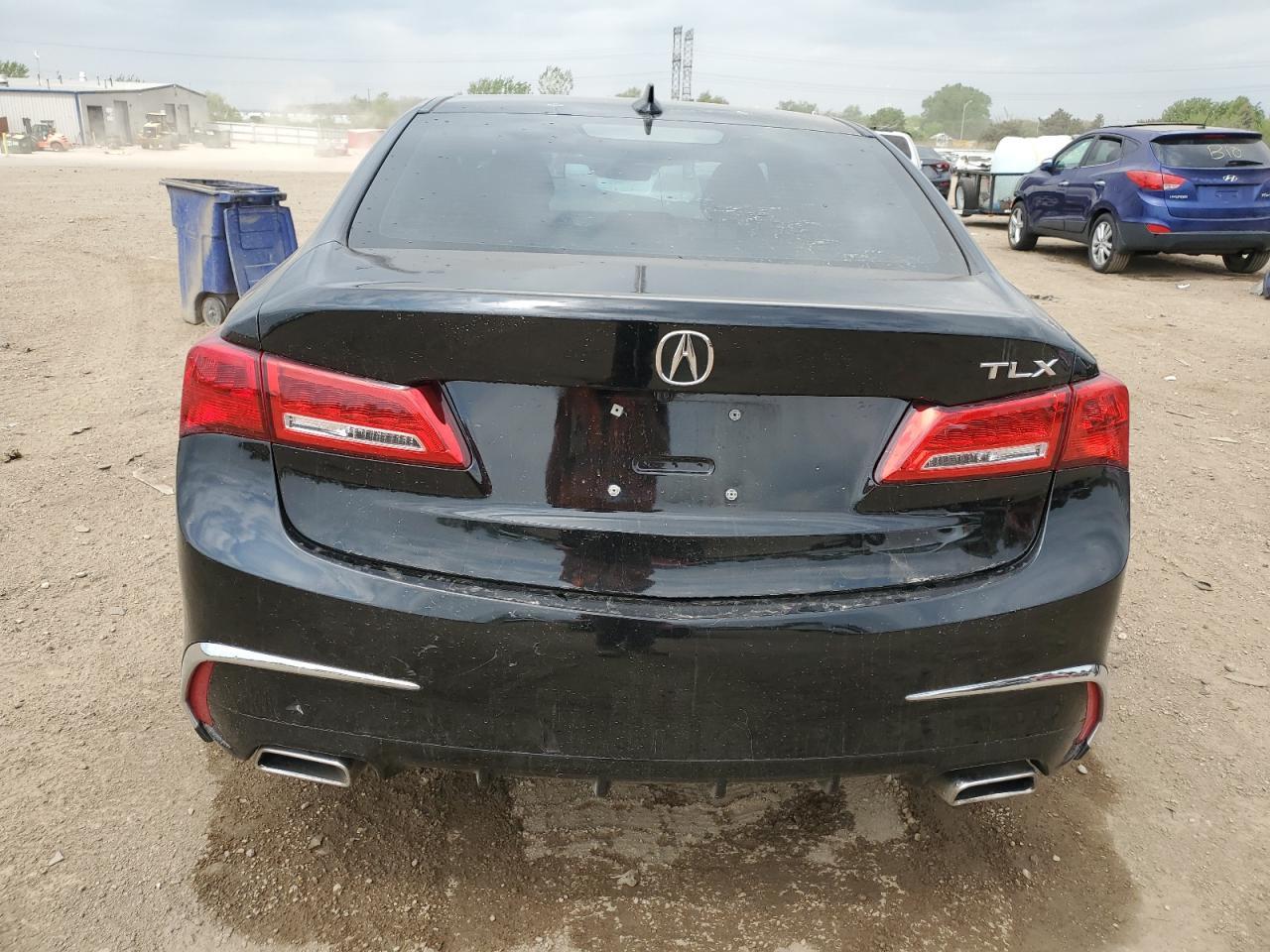 2019 Acura Tlx - Фото 6
