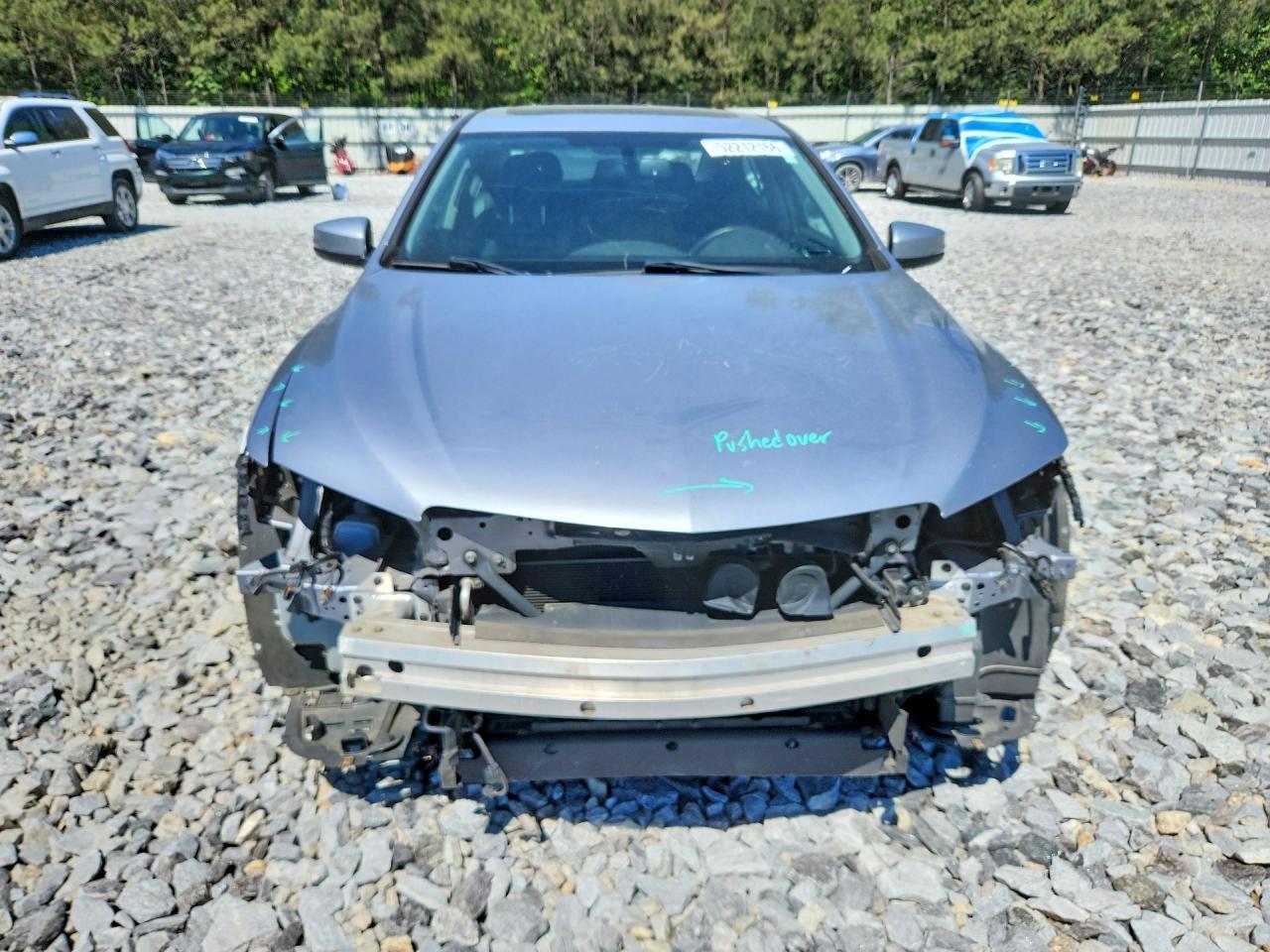2015 Acura Tlx - Фото 5