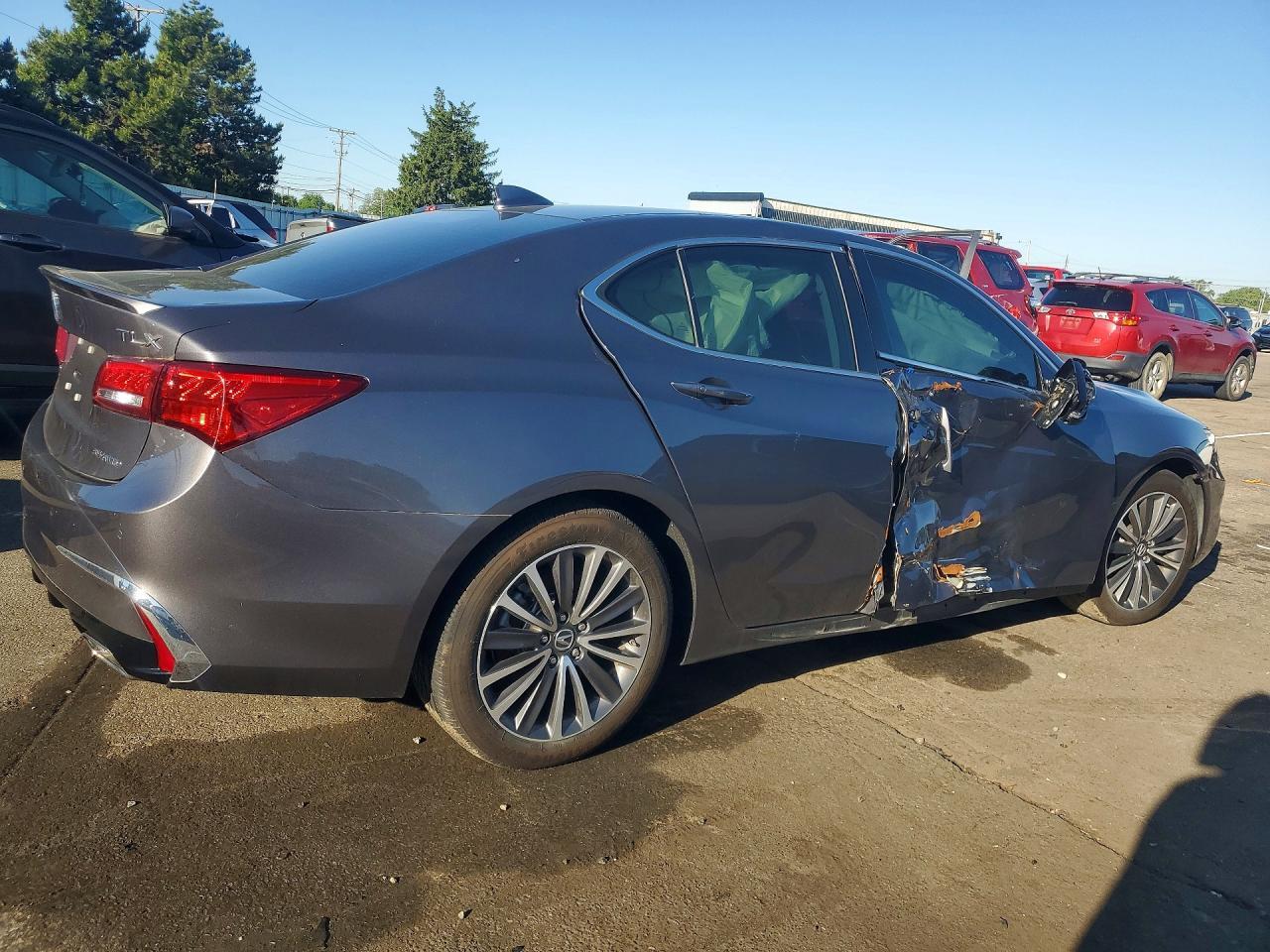 2018 Acura Tlx Advance - Фото 3