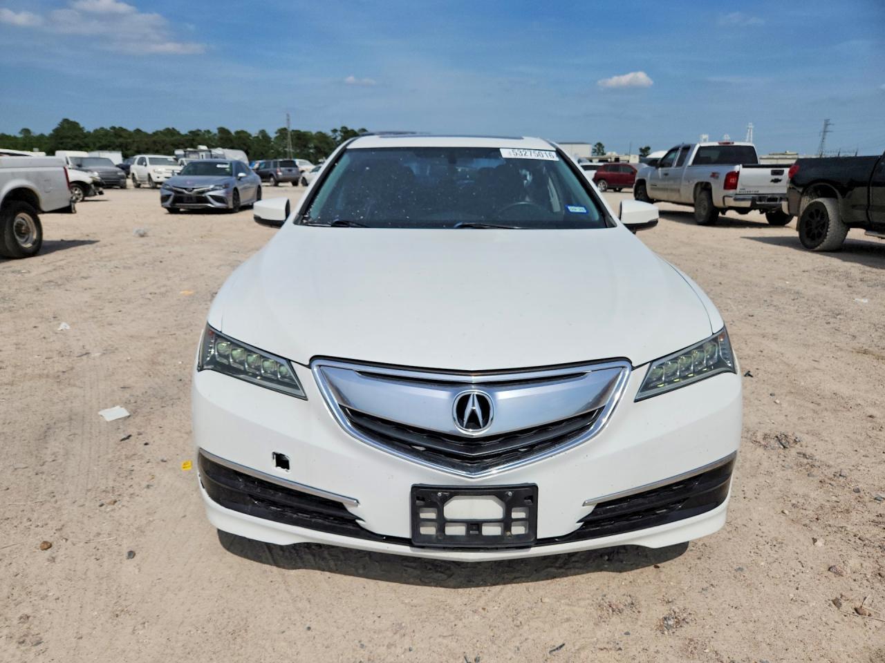 2017 Acura Tlx - Фото 5