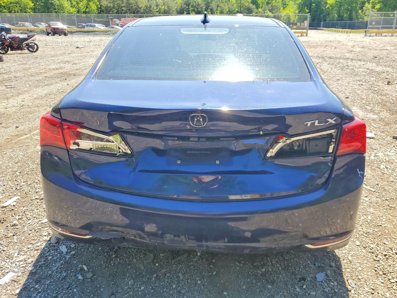2018 Acura Tlx - Фото 6