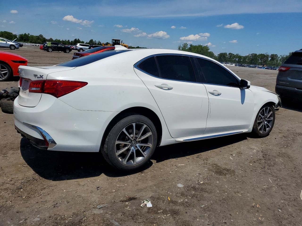 2018 Acura Tlx Tech - Image 3