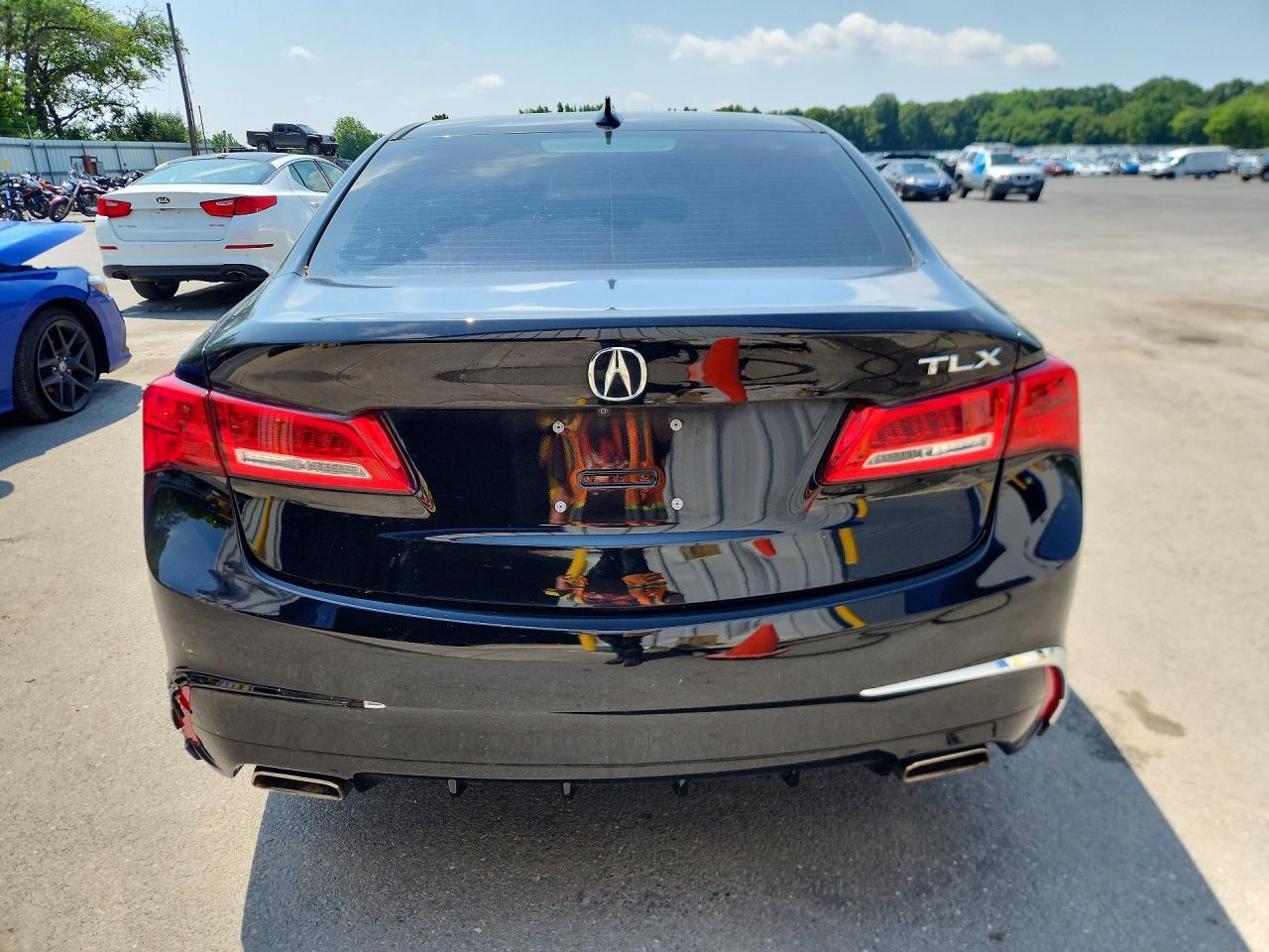 2018 Acura Tlx - Image 6
