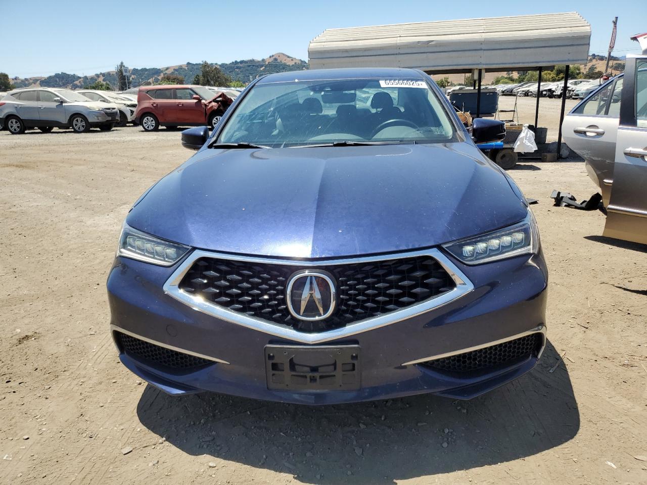 2018 Acura Tlx Tech - Фото 5