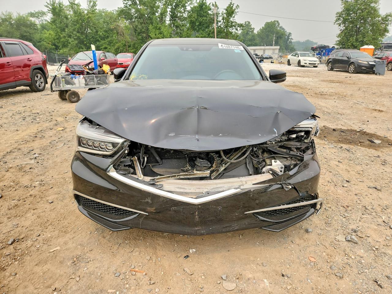2018 Acura Tlx - Фото 5