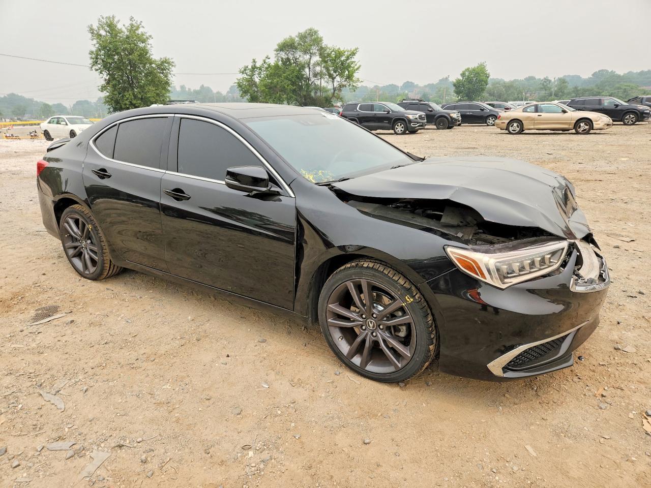 2018 Acura Tlx - Фото 4