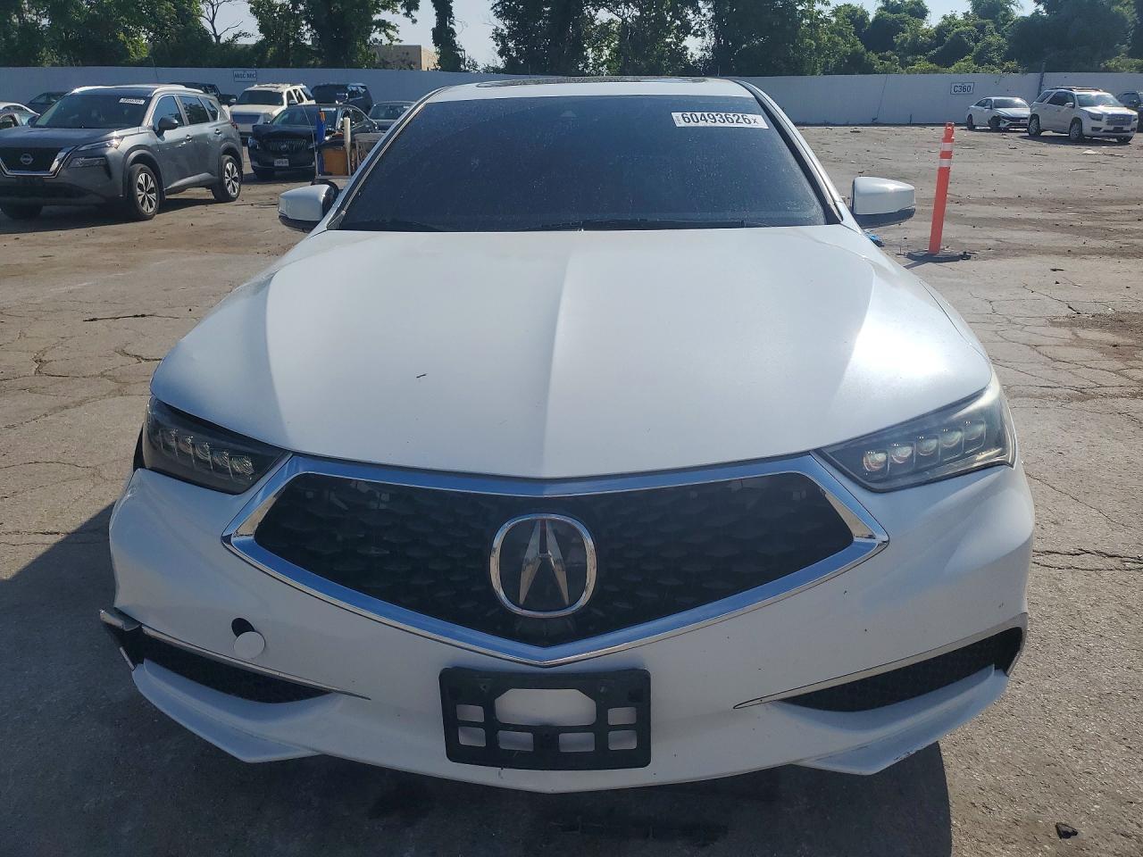 2018 Acura Tlx - Фото 5
