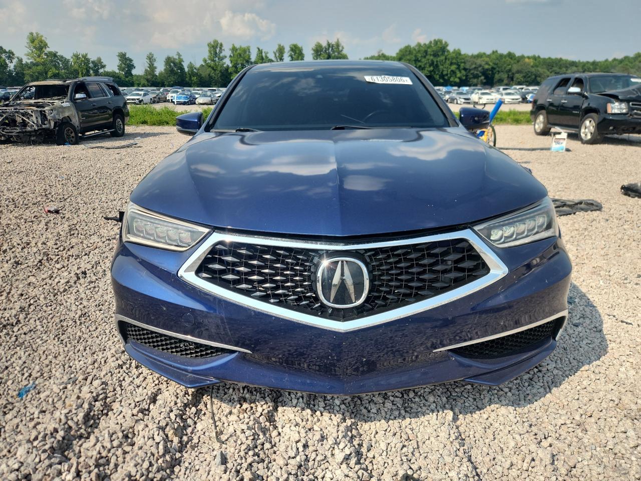 2018 Acura Tlx - Фото 5