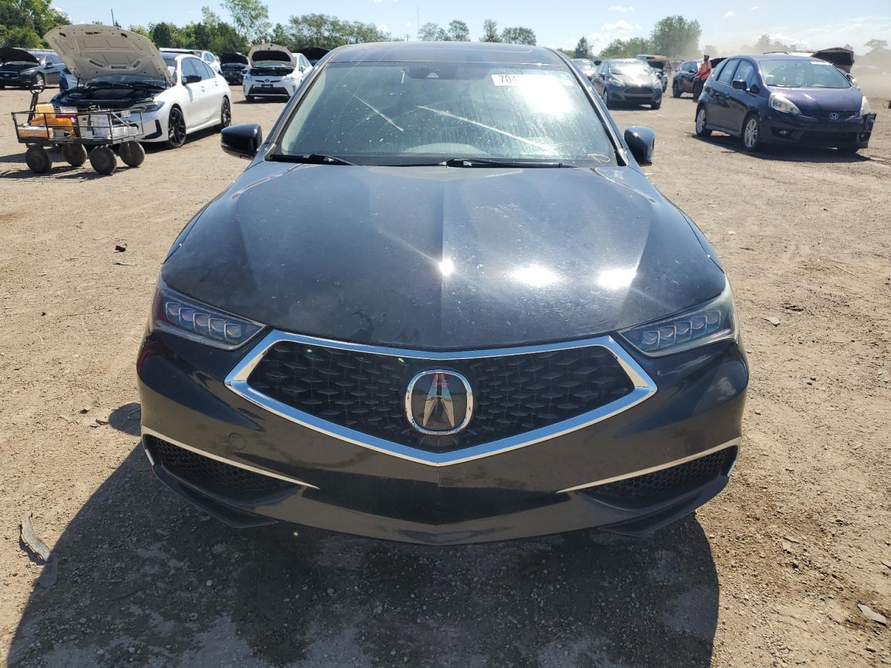 2018 Acura Tlx - Фото 5