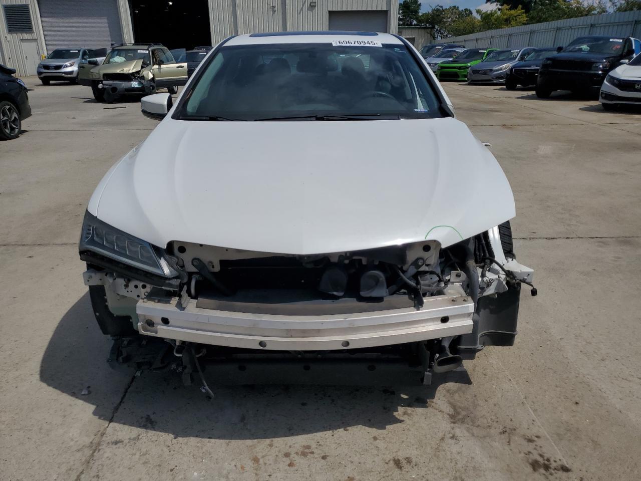 2015 Acura Tlx - Фото 5