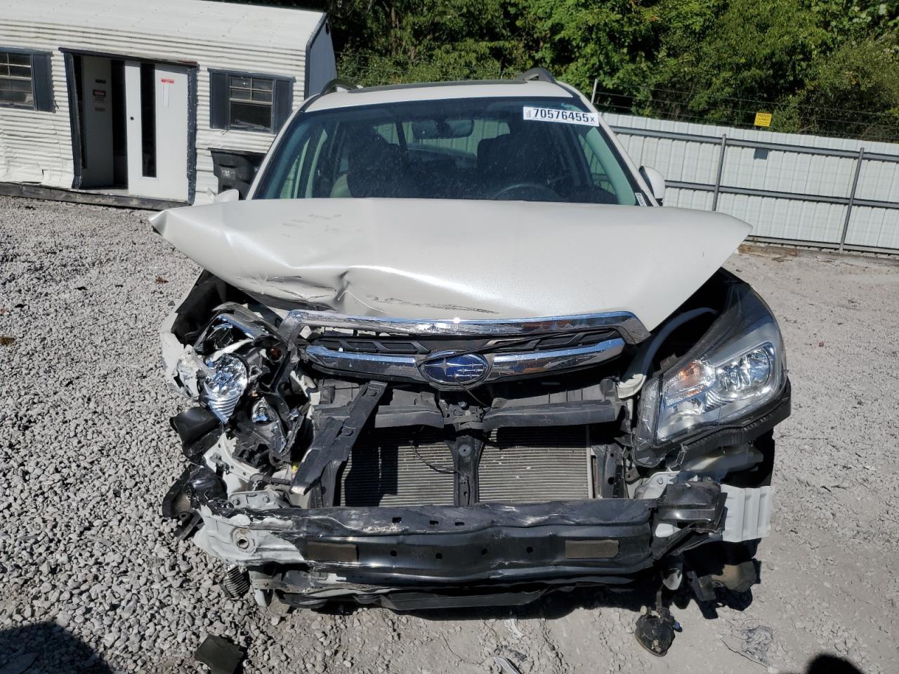 2017 Subaru Forester 2.5I Limited - Image 5