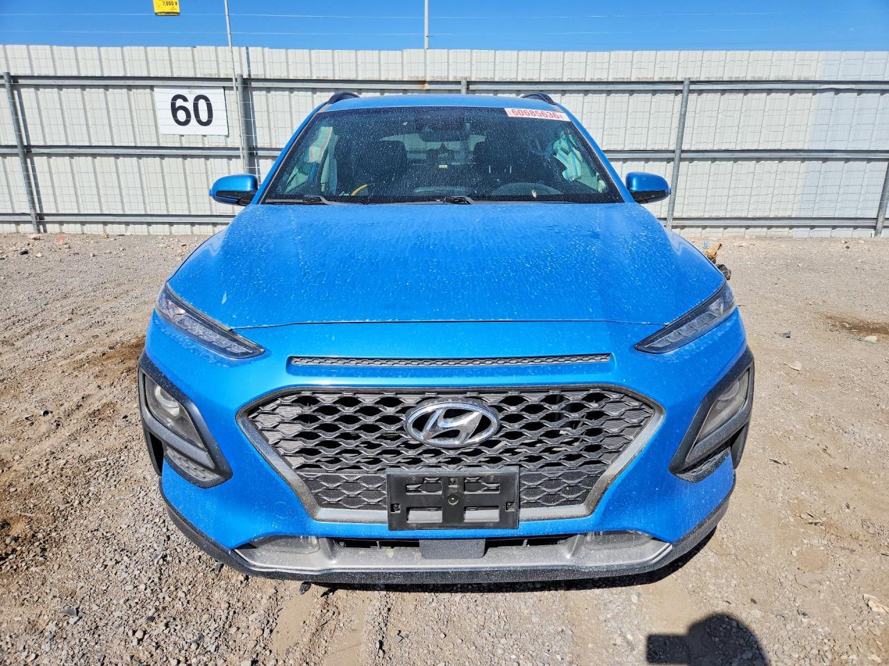 2018 Hyundai Kona Ultimate - Фото 5