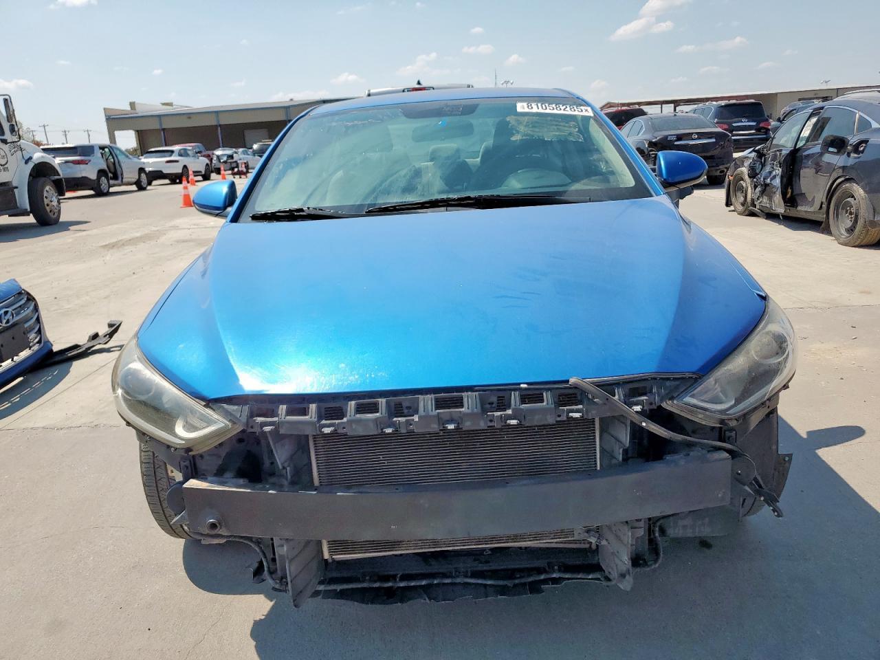 2017 Hyundai Elantra Se - Фото 5