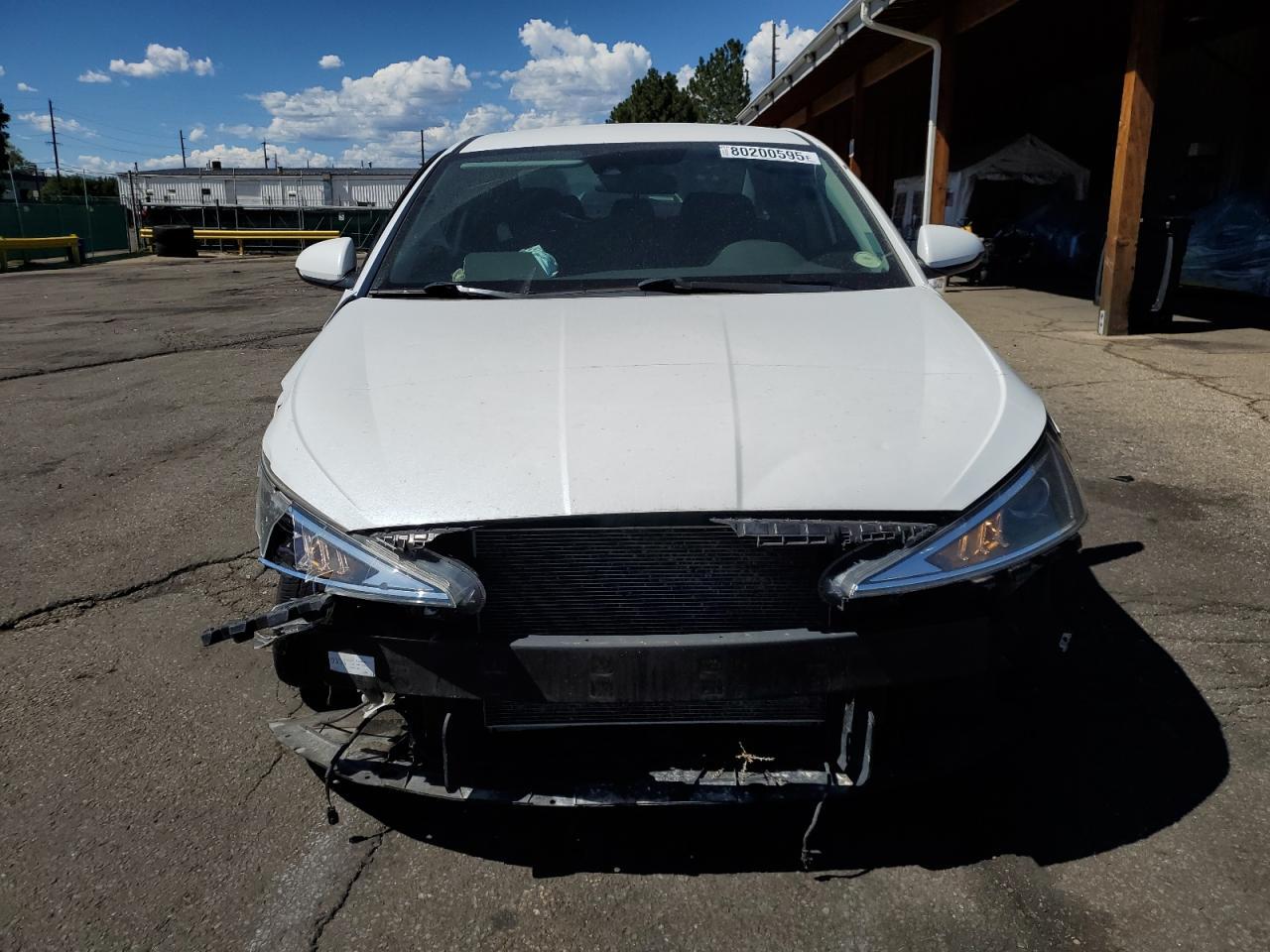 2020 Hyundai Elantra Sel - Фото 5