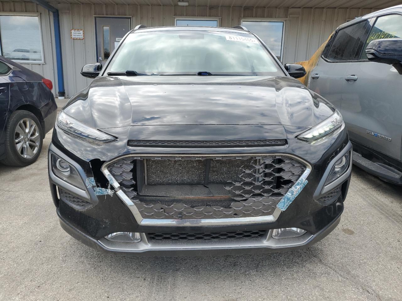 2018 Hyundai Kona Limited - Фото 5