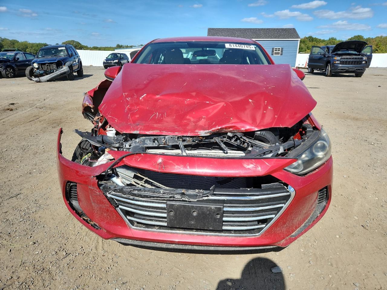 2017 Hyundai Elantra Se - Фото 5
