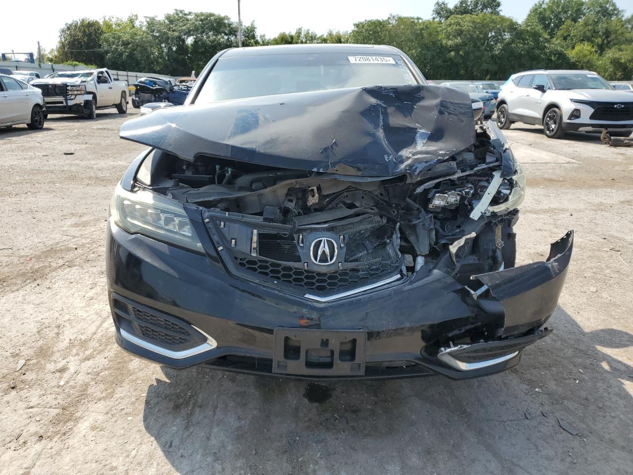 2017 Acura Rdx Technology - Image 5