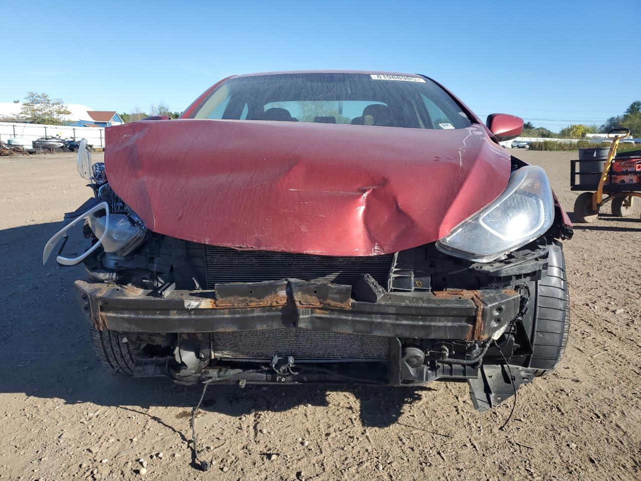 2015 Hyundai Elantra Se - Фото 5