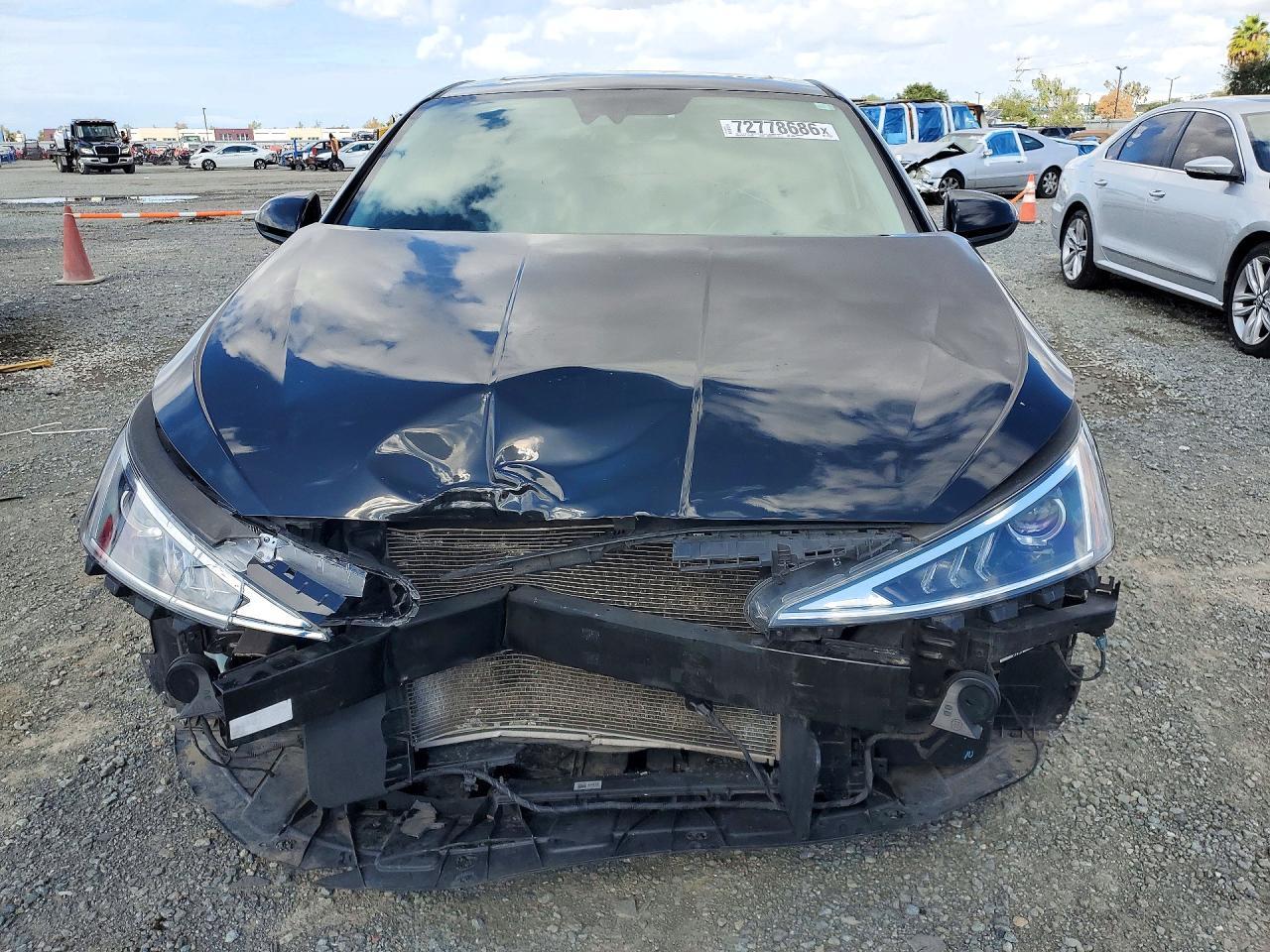 2020 Hyundai Elantra Value Edition - Image 5