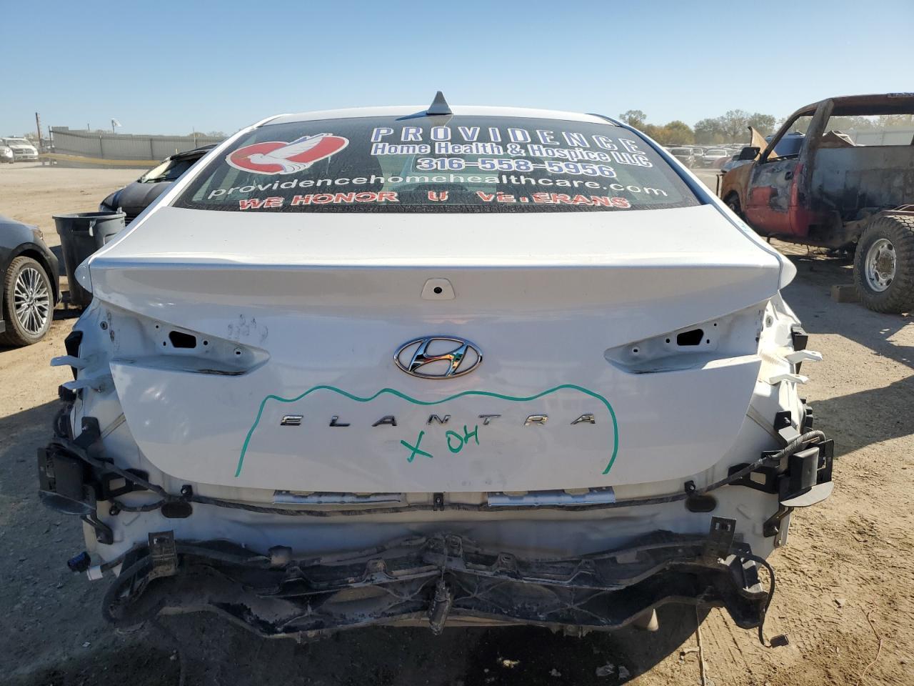 2020 Hyundai Elantra Sel - Фото 6