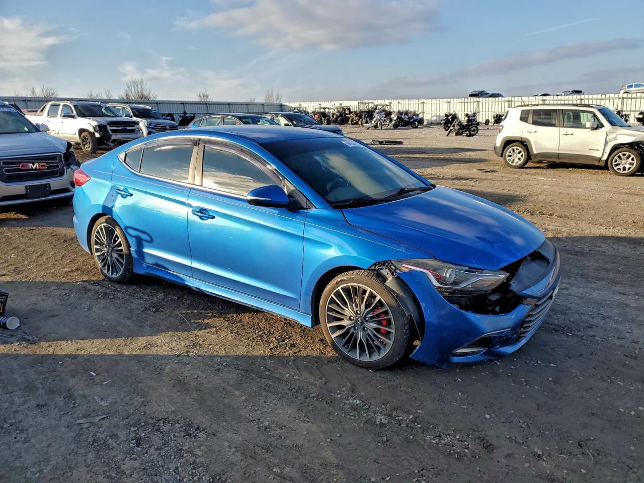 2017 Hyundai Elantra Sport - Фото 4